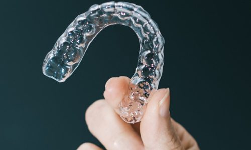 WHAT-ARE-THE-ADVANTAGES-OF-CLEAR-ALIGNERS